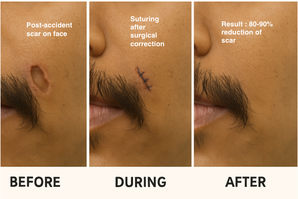 Accident Scars - Dr. Monali's Homeopathy Clinic Clinical Results
